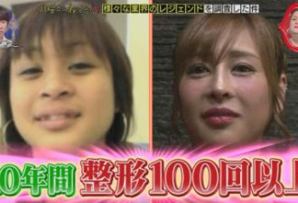 女孩整容用了10年时间花费2000万日元
