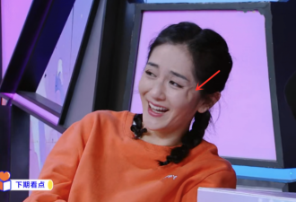 谢娜的脸怎么了？笑起来眼角出现奇怪大坑