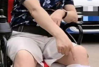 潘长江打石膏坐轮椅 仍然坚持现身拍戏