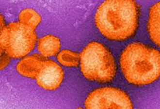最新研究：玻利维亚发现类似埃博拉病毒