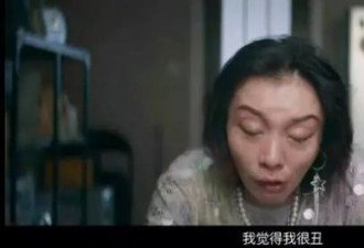 44岁赵薇自曝“整容后遗症”
