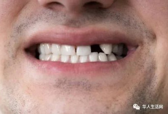 牙齿出现这些问题，可能是你感染了新冠病毒