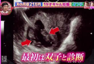19岁日本辣妹生下4胞胎，&quot;穷养育儿&quot;获赞赏