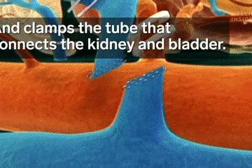 3D动画揭秘：医生手术时 对切开的身体做了什么