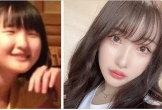 日本少女被亲生父亲嫌丑，16岁开始整容