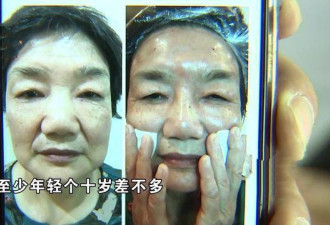 大姐花25万整形 “慈眉善目”变得“很凶很凶”