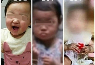 南韩1岁女童全身骨折惨死 养父母丢墓地