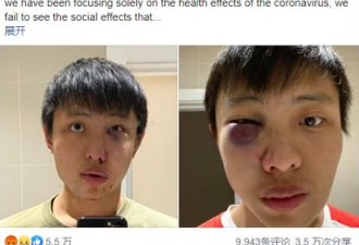 亚裔留学生因疫情歧视遭殴，判决让英网友怒了
