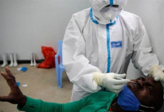 东非国家爆不明疾病 患者狂吐血 已10多人丧命