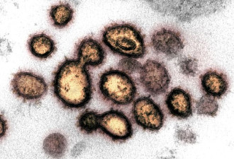 4000病毒变种挑战人类 混合使用不同疫苗管用？