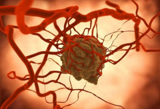 中国科学家用砒霜"修复"抑癌蛋白 临床试验启动