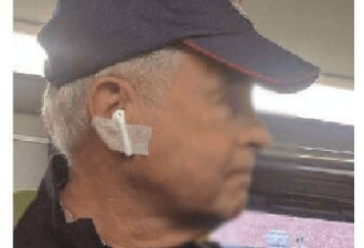 戴AirPods睡着 醒来发现耳机掉到肚子里