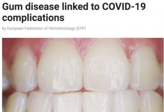 研究:患牙周炎恐使染新冠死亡风险激增