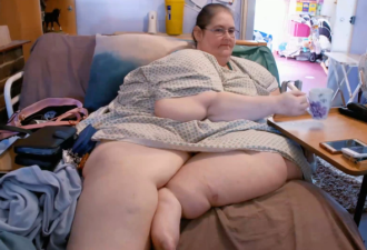 英最胖女子逆袭：床上躺8年，减肥后癌症消失