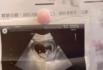 台湾变性网红自曝成功怀孕，没子宫也能生娃？