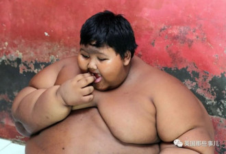 世界上最胖的孩子，用5年时间成功改命