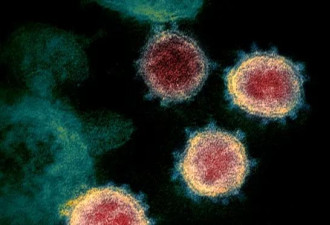 详解全球首个新冠病毒“人体挑战试验”