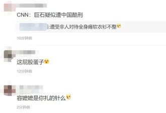 巨石强森扎中国针灸治伤 连屁股蛋子都没被放过