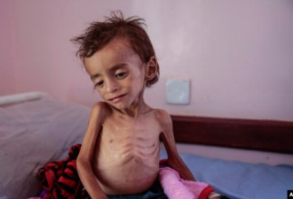 联合国：需要近40亿美元来防止也门大饥荒