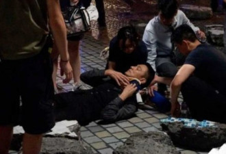 刘德华惊传拍片出现意外，手不慎遭割伤流血