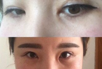4女子整容致9级伤残 院长：大不了不赔钱