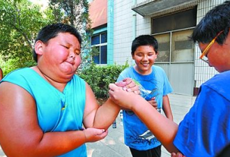 10岁男孩长出D罩杯？这问题很多小孩都有