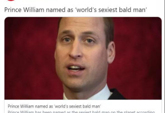 威廉王子是全世界最性感的秃头？！网友吵翻