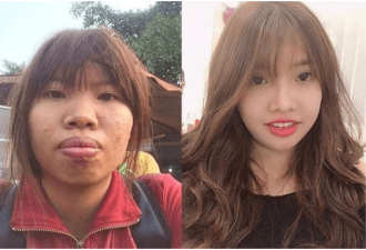 女子因容貌丑陋被丈夫嫌弃离婚