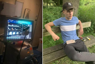 英国“脑死亡”男子在做器官捐献手术前苏醒