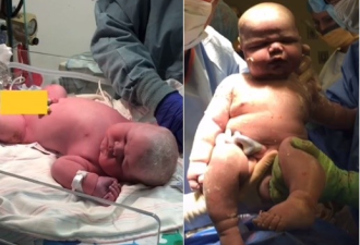 她生下6.5kg巨婴惊呆网友5年后现况曝光