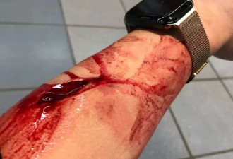 中国留学生遭袭!血肉模糊!路人冷漠!大使馆发文