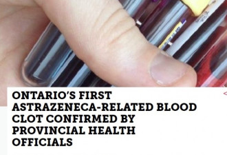 安省出现首例接种阿斯利康疫苗后血栓