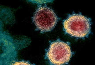 又一组科学家呼对新冠病毒起源进行更深入调查