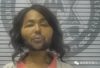 他为变性整容两次抢银行 然而做完手术这效果