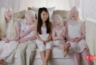 加州夫妇登实境秀：收养中国5童 4个患白化症