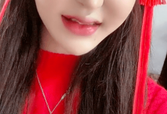 女网红整容上百次出现后遗症 太热导致玻尿酸融