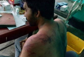 印度24人围殴医 导致上万名医生撂挑子