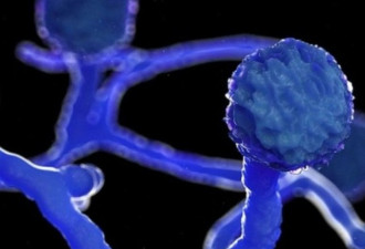 印度爆毛霉菌 疑因用“过量抗生素和锌”治新冠