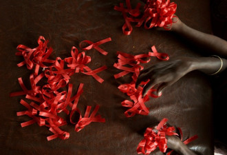 联合国大会过政治宣言到2030年结束艾滋病流行