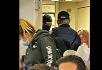 美一航班爆恐怖斗殴：空姐被乘客打掉2颗牙