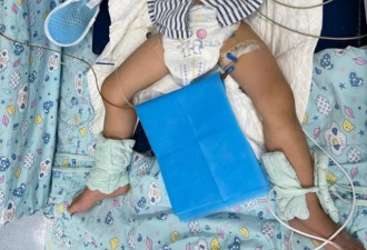 2岁男童往消毒片倒水致氯气中毒 抢救8天垂危