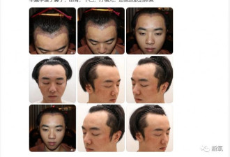 昨天，全网都在问：华晨宇到底整容了没有？