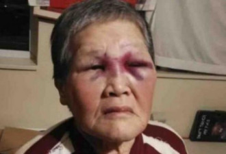 华裔律师：我为攻击华裔老太的美国男子辩护