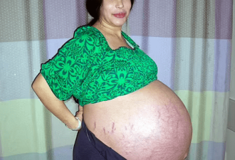 26岁女子自然怀孕诞下9胞胎 获资助百万英镑