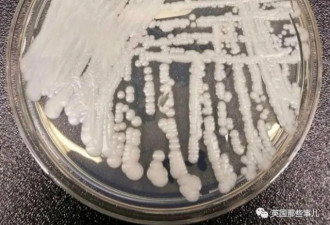 美国医院蔓延超级真菌 已感染百余人3死