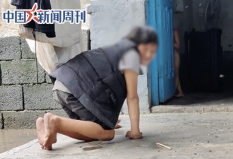 梅毒男7千元买妻连生9胎 幼子染病家中飞满苍蝇