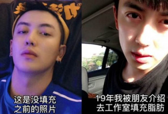 又一失败案例网红整容变毁容 神隐两年才敢露面