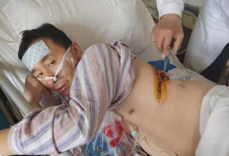 银行员工被蒙面男子捅7刀 警方鉴定其系自残
