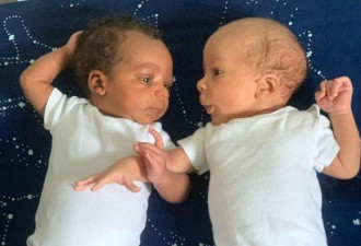 美父亲疑惑:双胞胎婴儿一黑一白来自不同种族?