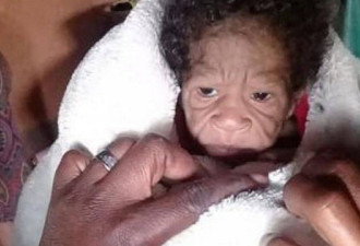 南非女子生下长相怪异的女婴 看起来比自己还老